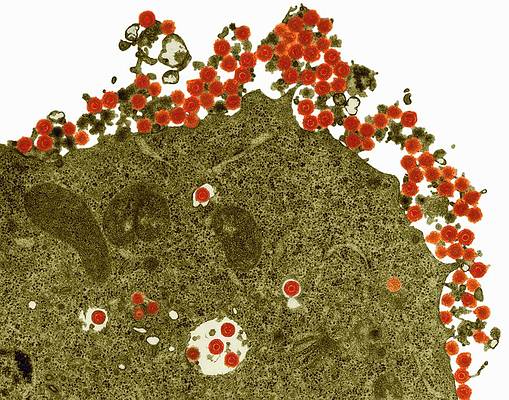 Herpes virus as seen under a microscope